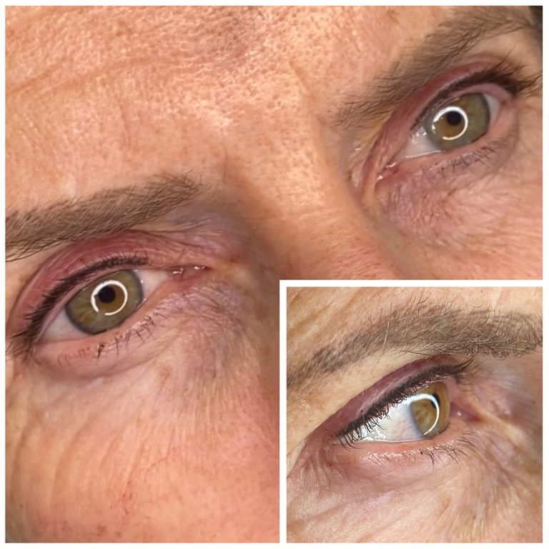 Eyeliner Enhancement