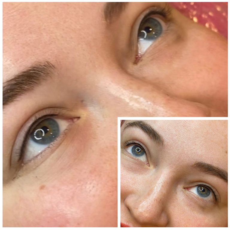 Eyeliner Enhancement