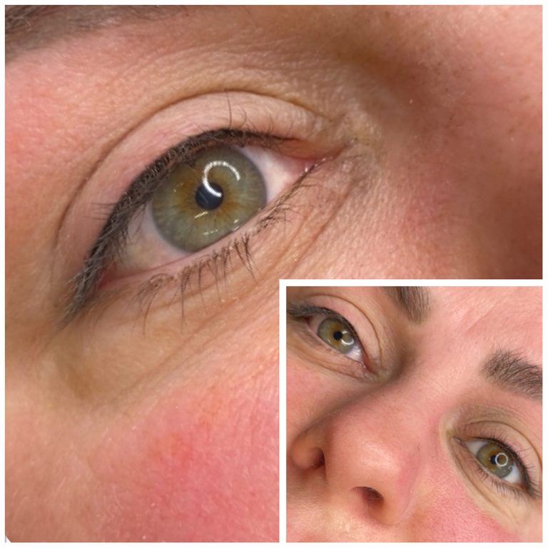 Eyeliner Enhancement